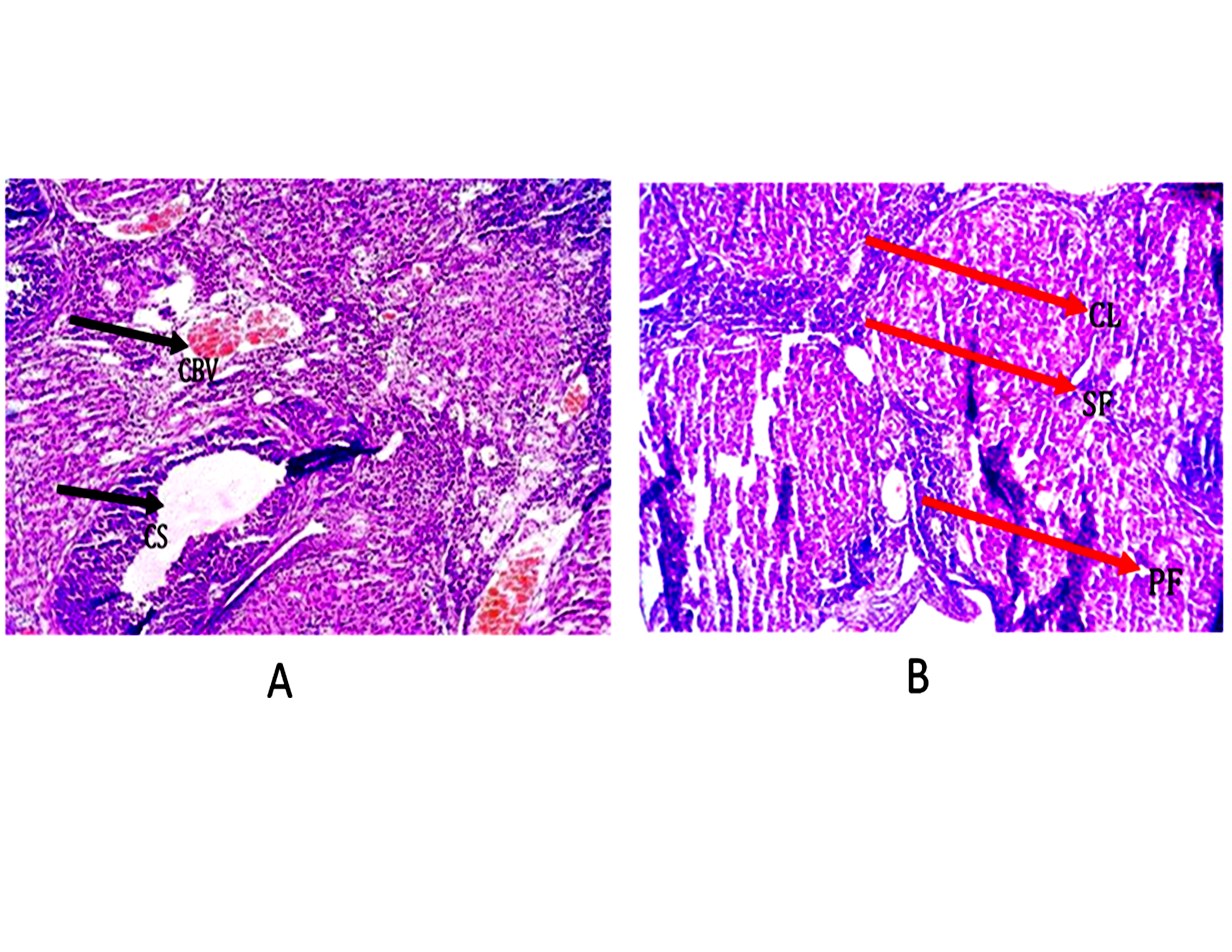 Histological section of the ovary of animals treated with HAART showing congested blood vessels and cystic spaces. H&E STAIN X100. CBV- Congested Blood Vessels, CS- Cystic Space and Control Group B: Histological section of the ovary of the control group animals showing a well-defined follicle and corpora lutea at varying stages of development. Also, it indicates a well outlined ovarian cortex and medulla with no abnormalities seen. H&E STAIN X100. CL- Corpora Lutea, PF- Primary Follicle., SF- Secondary Follicle.
